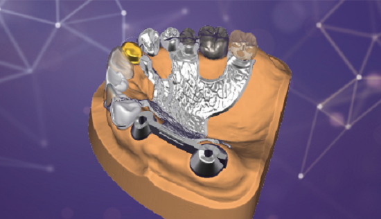 exocad��������������